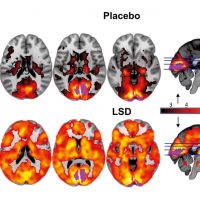 lsd study effects on the brain